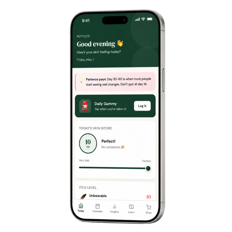 Eczema Trigger Tracker App