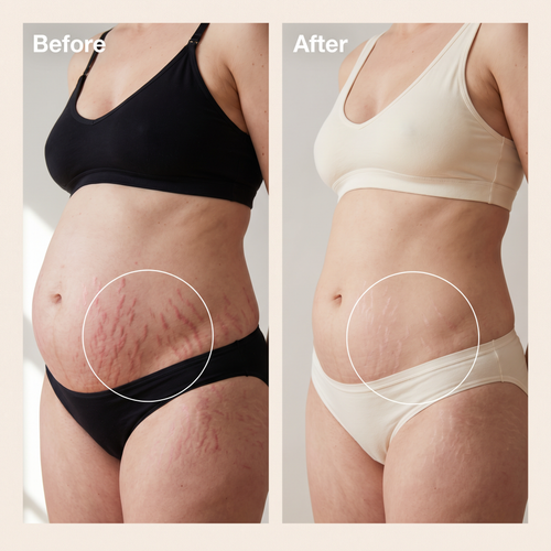 True Belly Serum