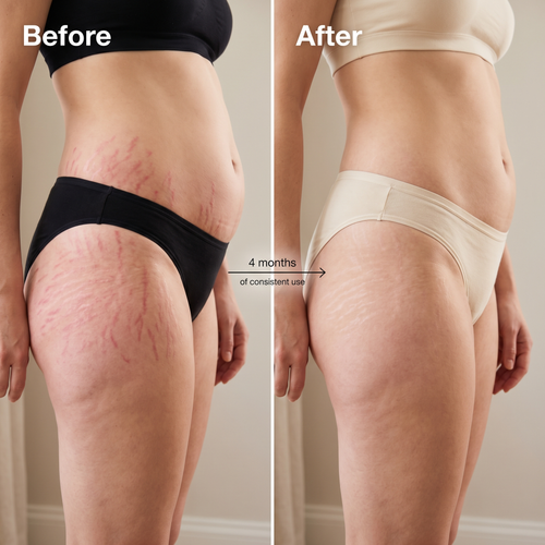 True Belly Serum